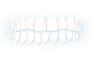 Khớp cắn chéo